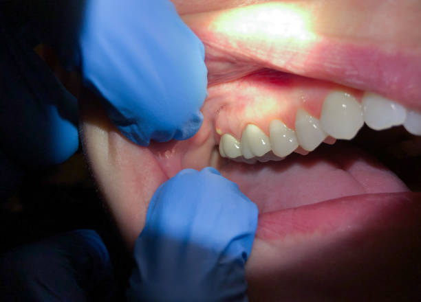 Best Emergency Treatment for Toothache in Morris, IL