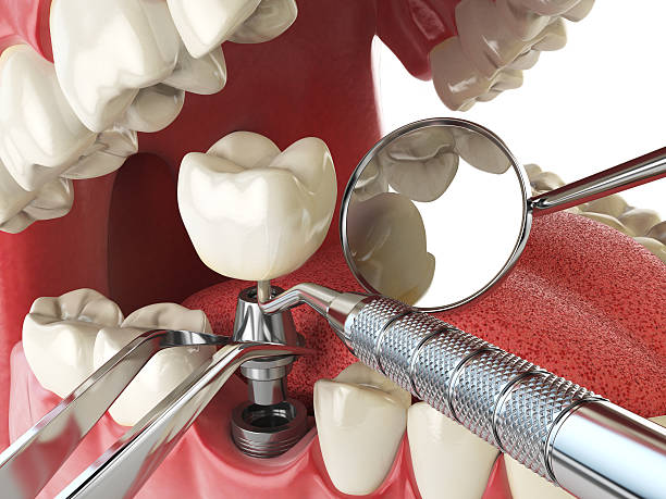 Best Emergency Dental Surgery in Morris, IL